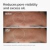 The Ordinary Niacinamide 10%, Zinc 1%