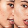 e.l.f. SKIN Blemish Breakthrough Blemish Control Basics Kit, Travel-Size Acne Skincare Routine